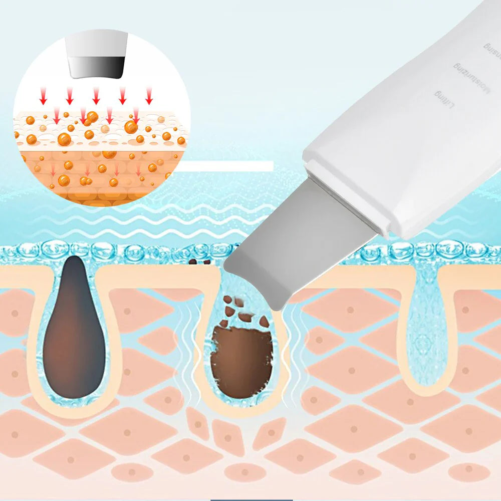 Ultrasonic Skin Scrubber Pro