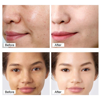 Retinol Cream