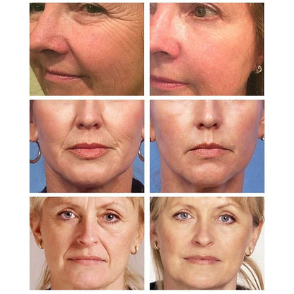 Gold Nicotinamide Anti-Ageing Essence